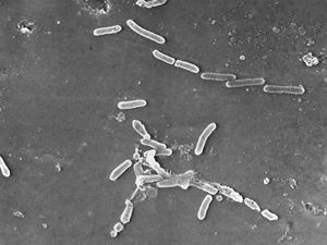 (Janice Haney Carr | CDC via AP) This scanning electron microscope image made available by the Centers for Disease Control and Prevention shows rod-shaped Pseudomonas aeruginosa bacteria. Experts are marveling at how U.S. disease detectives figured out how eyedrops were linked to dozens of infections.